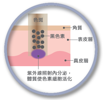 特证美白祛斑霜,跟“斑”说拜拜(图5)