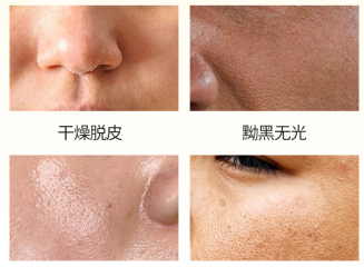 image.png 图片