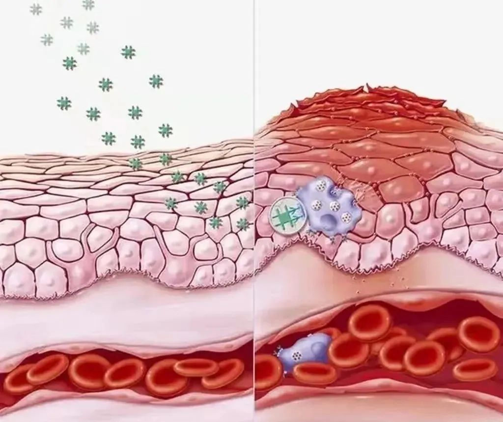 细胞专刊丨疾病的罪魁祸首，干细胞有效减轻炎症反应